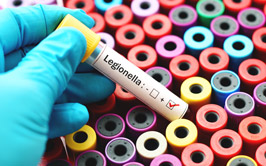 Legionella Testing Laboratory Michigan