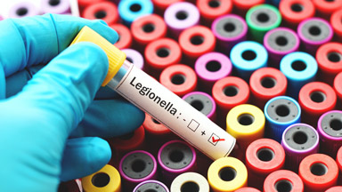 Michigan Legionella Testing Laboratory